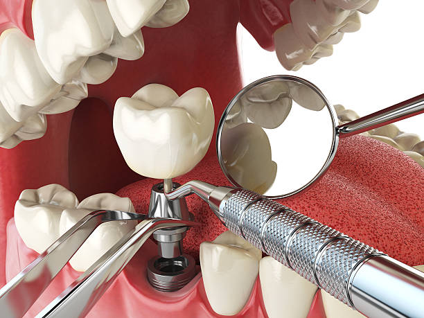 Best Walk-In Emergency Dentist in Quincy, FL